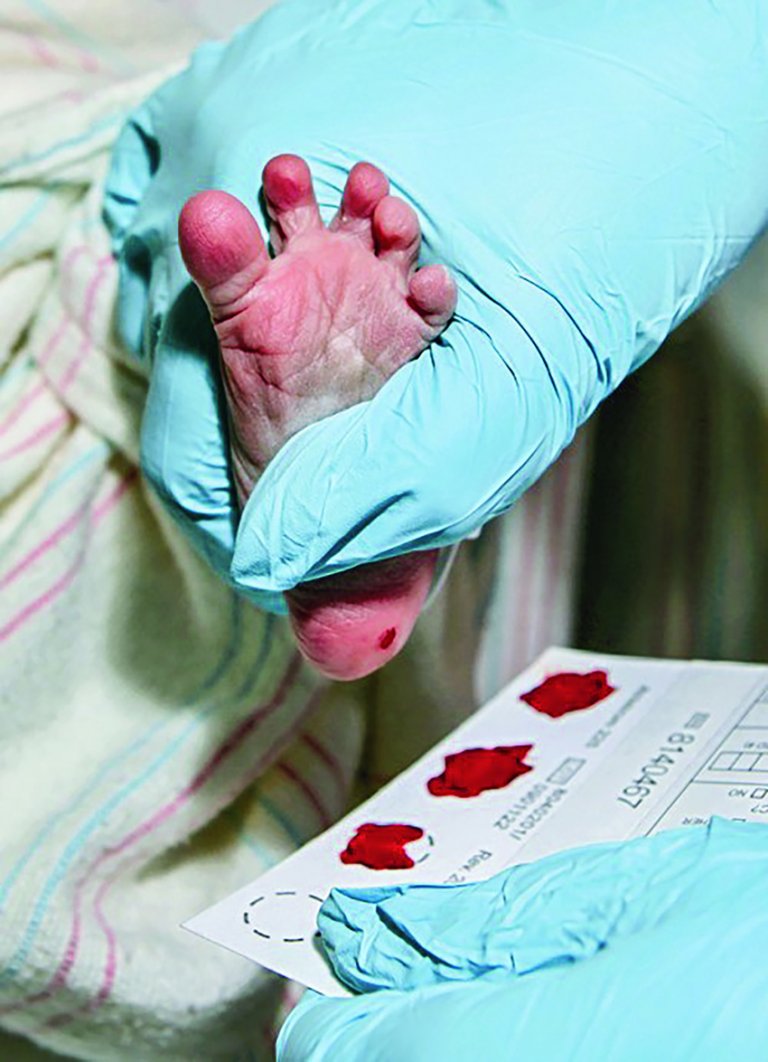 為嬰兒驗血可查出代謝性罕見病。
