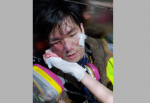 【暴亂不止】示威者旺角深夜放火堵路　警方催淚彈擊中學生記者